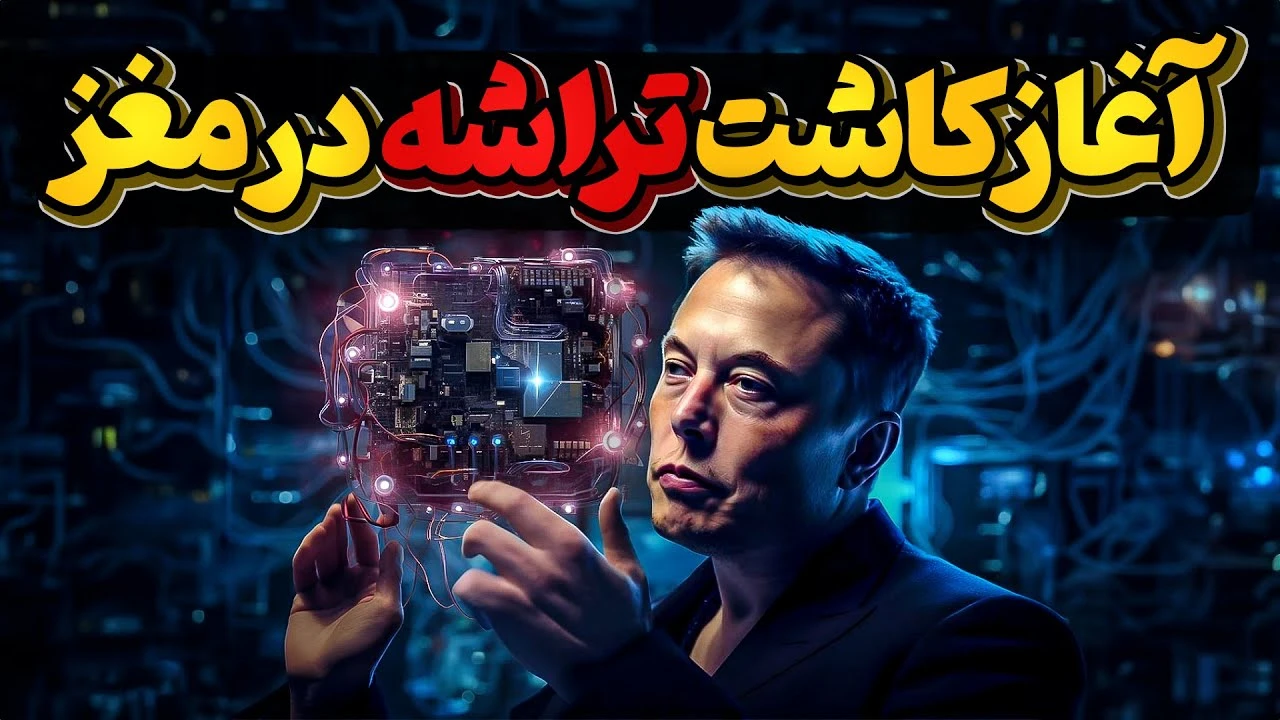 آغاز کاشت تراشه در مغز