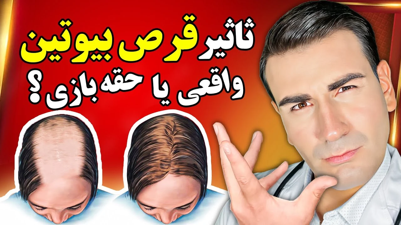 آیا مصرف قرص بیوتین از ریزش مو جلوگیری میکنه ؟!